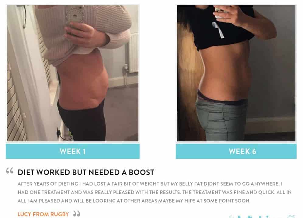 Before and After Dieting Hounslow