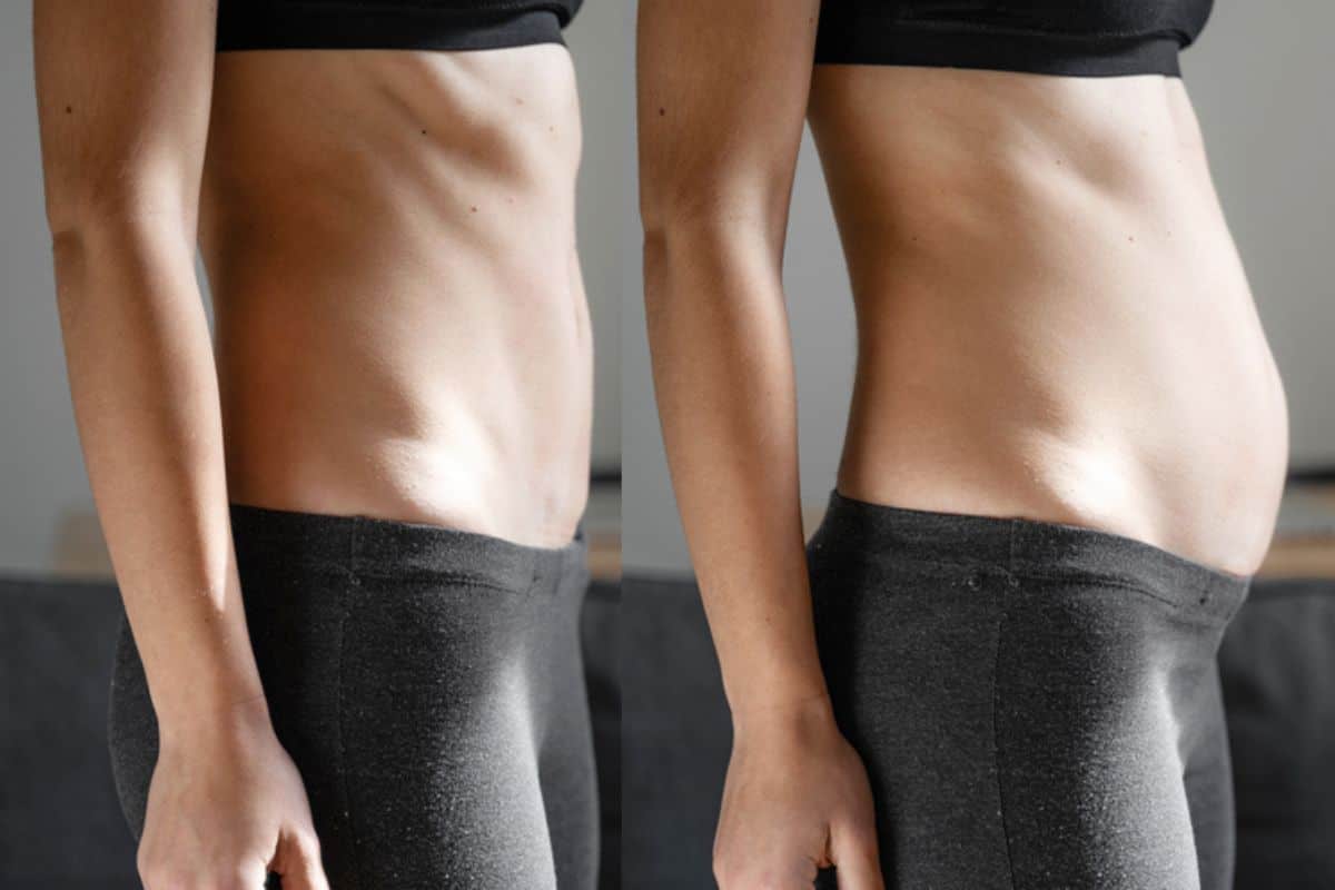 How long does diastasis recti take to improve Hounslow?
