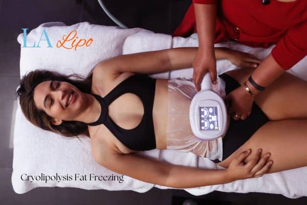 woman getting cryolipolysis Hounslow