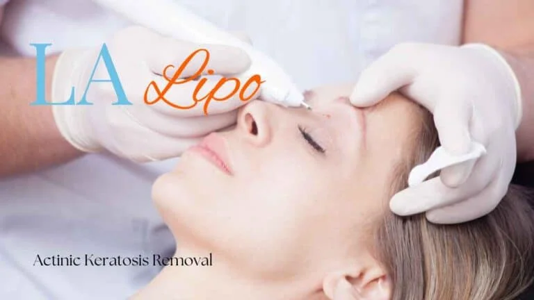 Woman receiving Actinic Keratosis Removal Treatment Hounslow
