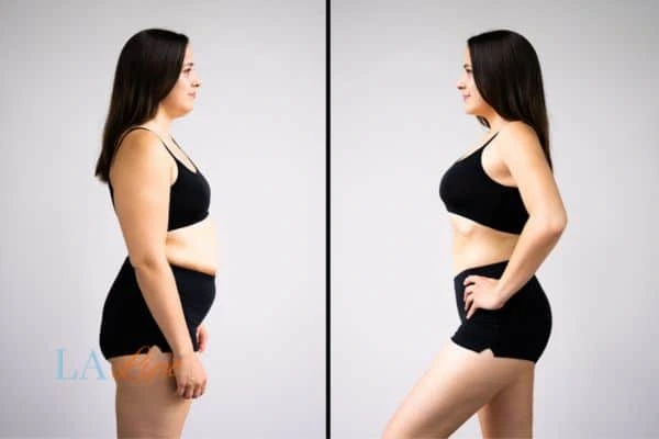 LA-EMS Body Sculpting Hounslow results before and after of womans results on body toning.