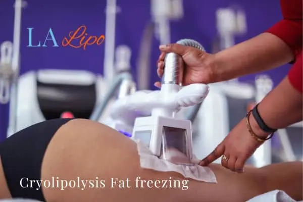 women getting fat freezing Hounslow
