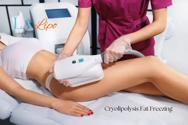 Woman receiving coolsculpting Hounslow treatment on her thighs