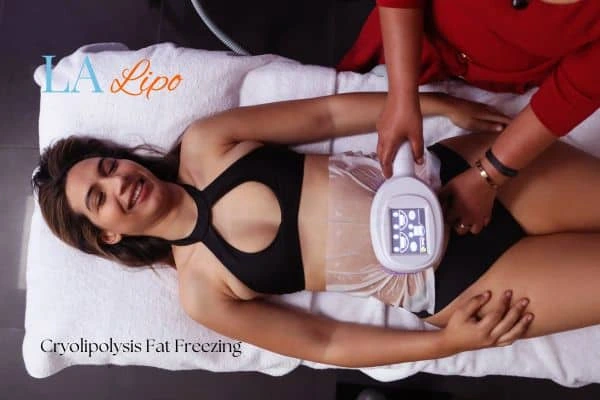 woman getting cryolipolysis Hounslow
