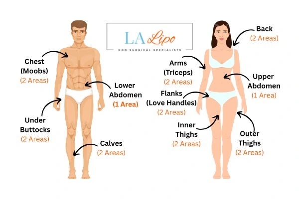 LA LIPO Cryolipolysis Areas Hounslow