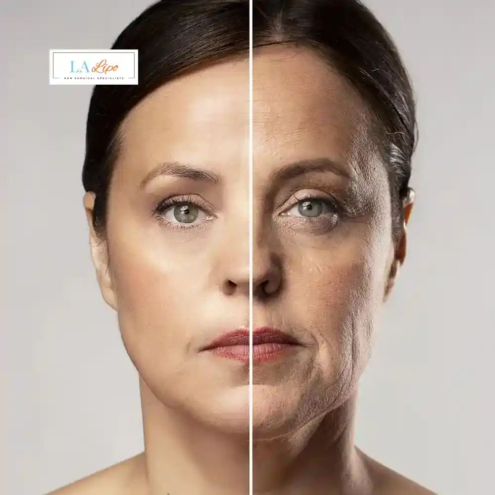 How Can You Tell If Non-Surgical Skin Tightening Is Right for You Hounslow?