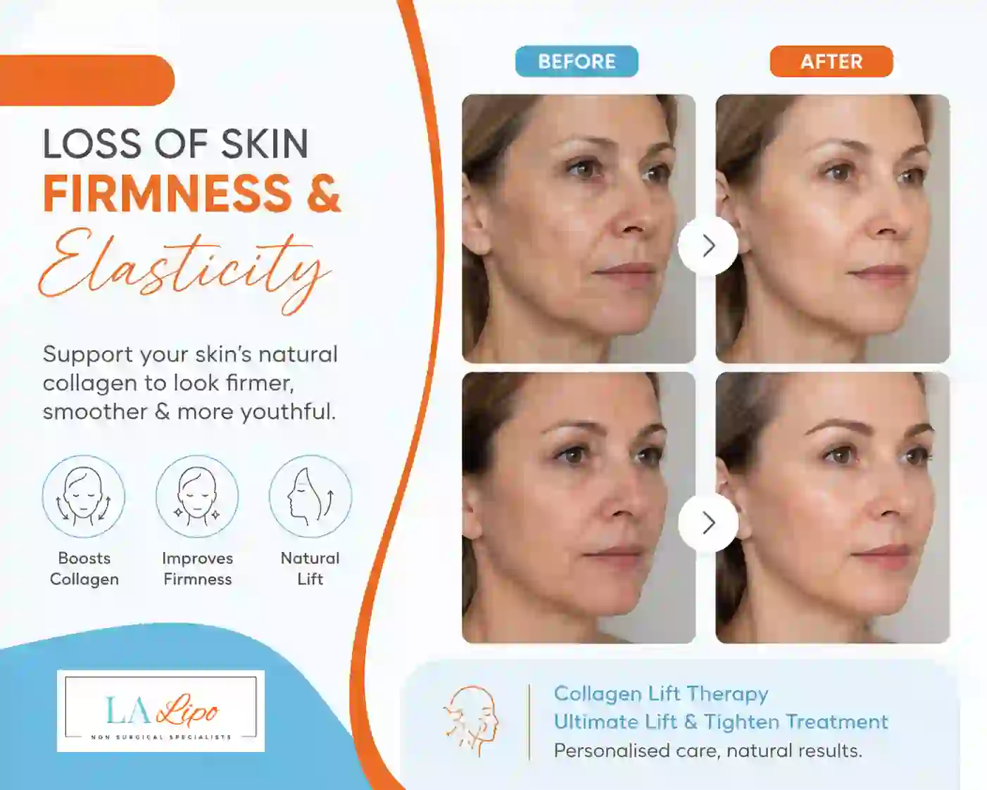 Sign #7: Loss of Skin Firmness and Elasticity Hounslow