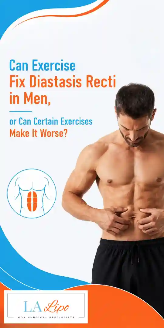 Can Exercise Fix Diastasis Recti in Men, or Can Certain Exercises Make It Worse Hounslow?